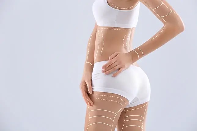 PRMA-what-are-body-makeovers