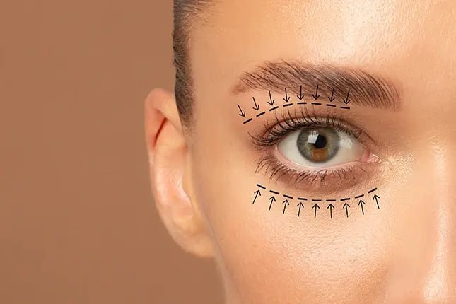 PRMA-what-is-eyelid-surgery