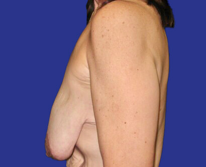 img-1