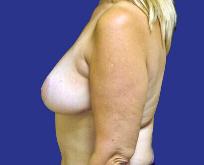 img-1
