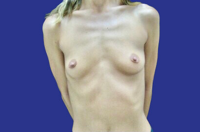 img-1