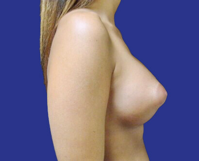 img-1